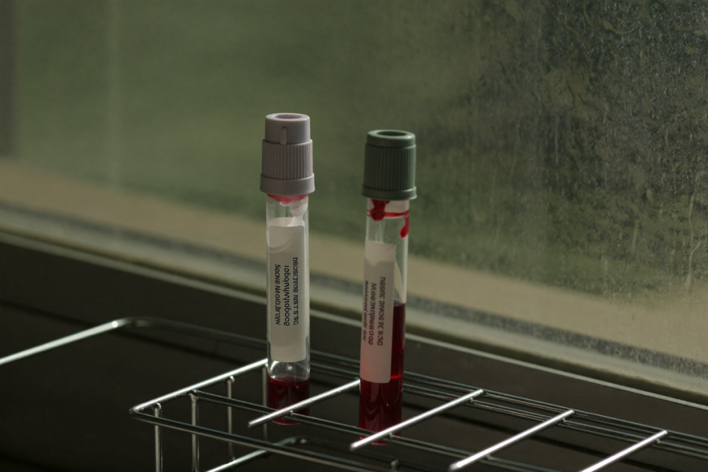 Two blank blood collection tubes in a rack by a window in early morning light
