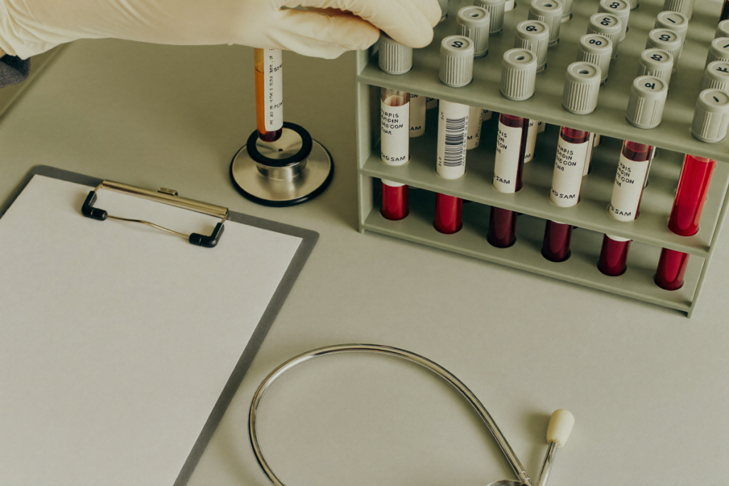 Blood collection tubes in a lab rack representing hormone lab monitoring